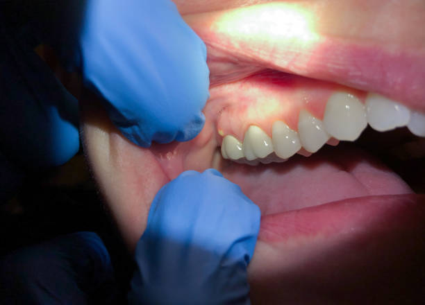 Best 24-Hour Emergency Dental Care in Lake Of The Woods, VA